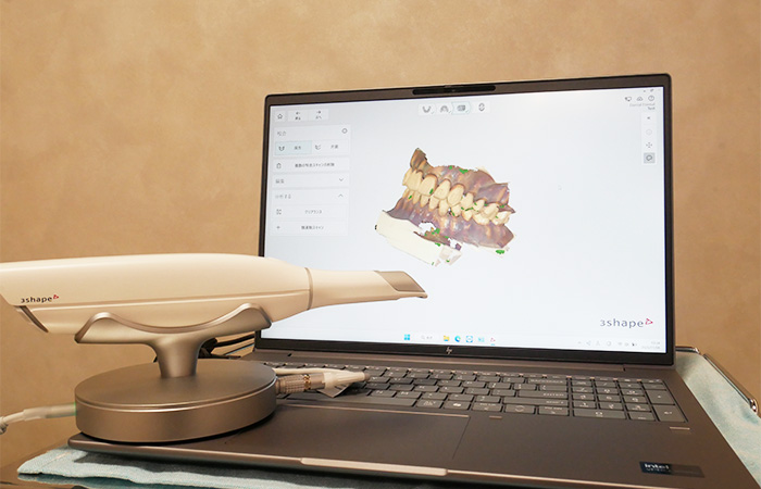 口腔内スキャナー