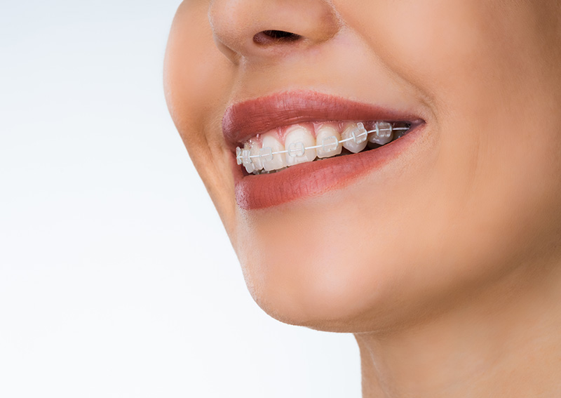 矯正歯科・小児矯正歯科