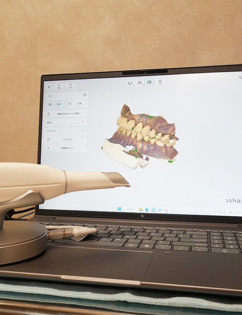 口腔内スキャナー